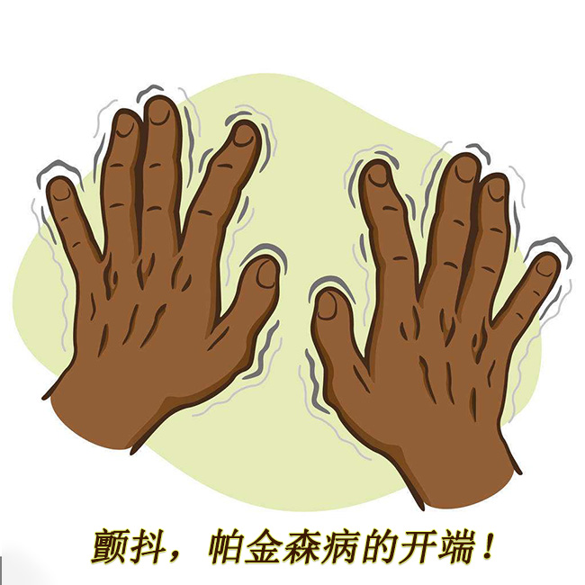 顫抖，帕金森病的開端 帕金森的早期癥狀